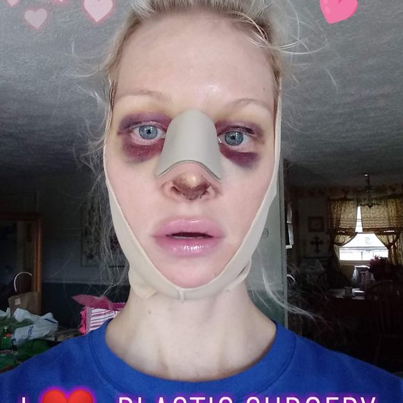 brittpsd